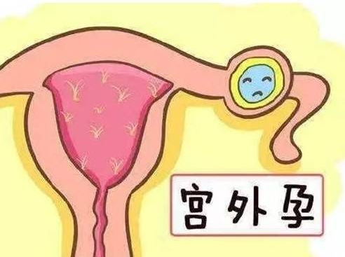 深圳借卵试管助孕：试管婴儿移植后也可能发生宫外孕，这些是宫外孕的主要原因