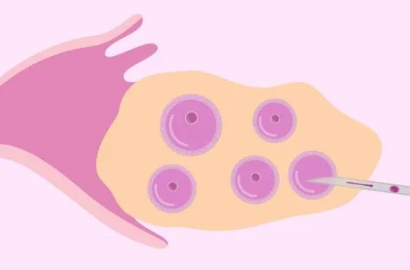 西安高龄供卵：安徽安医附院供卵试管婴儿的成功率估计! 介绍提高供卵试管婴儿成功率的方法。