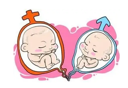 许昌助孕龙凤胎中介-有两个胎盘的羊水双胞胎的前壁通常是男孩还是女孩？
