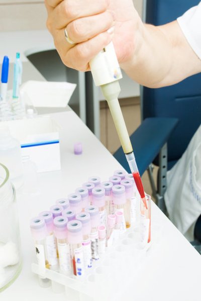 杭州助孕生子多少钱：一次完整的血液检查需要多少钱？