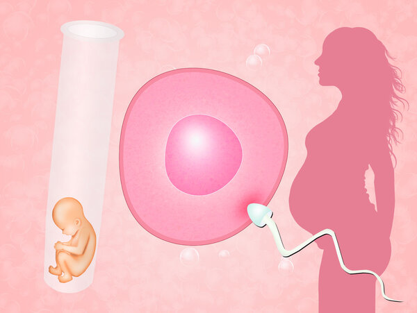 宁波那家中介能做供卵-试管婴儿过程是如何进行的？