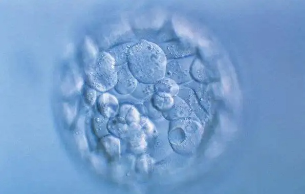 遵义供卵试管助孕包男孩费用：通过穿刺收集精子并不十分痛苦，可以在没有麻醉的情况下进行。